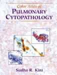 Color Atlas of Pulmonary Cytopathology w sklepie internetowym Libristo.pl