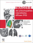 Imagerie des pneumopathies interstitielles diffuses (PID) w sklepie internetowym Libristo.pl