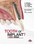 Tooth or Implant? The recovery or replacement of the severely compormised natural tooth w sklepie internetowym Libristo.pl