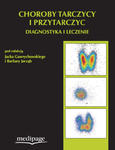 Choroby tarczycy i przytarczyc. Diagnostyka i leczenie w sklepie internetowym Ksiazki-medyczne.eu