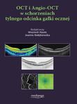 OCT i Angio-OCT w schorzeniach tylnego odcinka gałki ocznej w sklepie internetowym Ksiazki-medyczne.eu