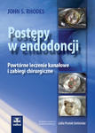 Postępy w endodoncji Powtórne leczenie kanałowe i zabiegi chirurgiczne. w sklepie internetowym Ksiazki-medyczne.eu