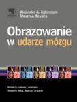 Obrazowanie w udarze mózgu w sklepie internetowym Ksiazki-medyczne.eu