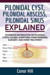 Pilonidal Cyst Fast Healing Guide. Fast Track Guide To Pilonidal Cyst Relief By Understanding The Pilonidal Sinus, Abscess, Causes, Symptoms, And Appl w sklepie internetowym Gigant.pl