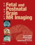 Atlas Of Fetal And Postnatal Brain Mr w sklepie internetowym Gigant.pl