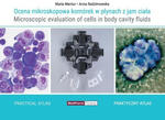 Ocena mikroskopowa komórek w płynach z jam ciała w sklepie internetowym LiberMed.pl