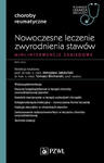 Nowoczesne leczenie zwyrodnienia stawów. Mini-interwencje zabiegowe w sklepie internetowym LiberMed.pl