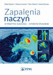 Zapalenia naczyń w praktyce klinicznej interdyscyplinarnie w sklepie internetowym LiberMed.pl