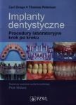 Implanty dentystyczne w sklepie internetowym ksiazki-naukowe.pl