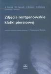 ZDJĘCIE RENTGENOWSKIE KLATKI PIERSIOWEJ 0,3/ CZELEJ w sklepie internetowym Booknet.net.pl