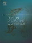 Dostępy operacyjne w ortopedii w sklepie internetowym Booknet.net.pl