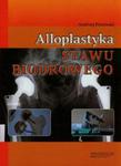 Alloplastyka stawu biodrowego w sklepie internetowym Booknet.net.pl