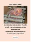 Choroba zwyrodnieniowa stawów, zespół przewlekłego zmęczenia, fibromialgia w sklepie internetowym Booknet.net.pl